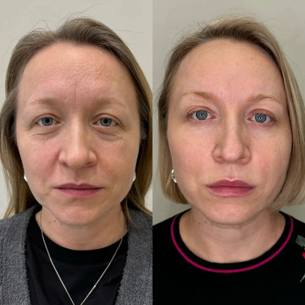 Carol A, 63