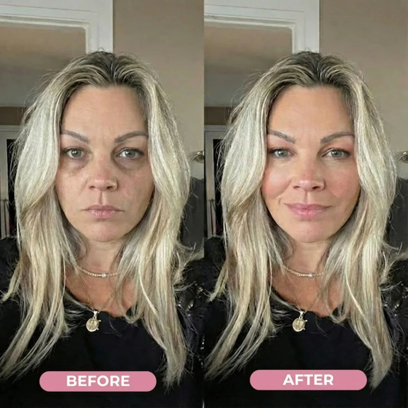 Before After